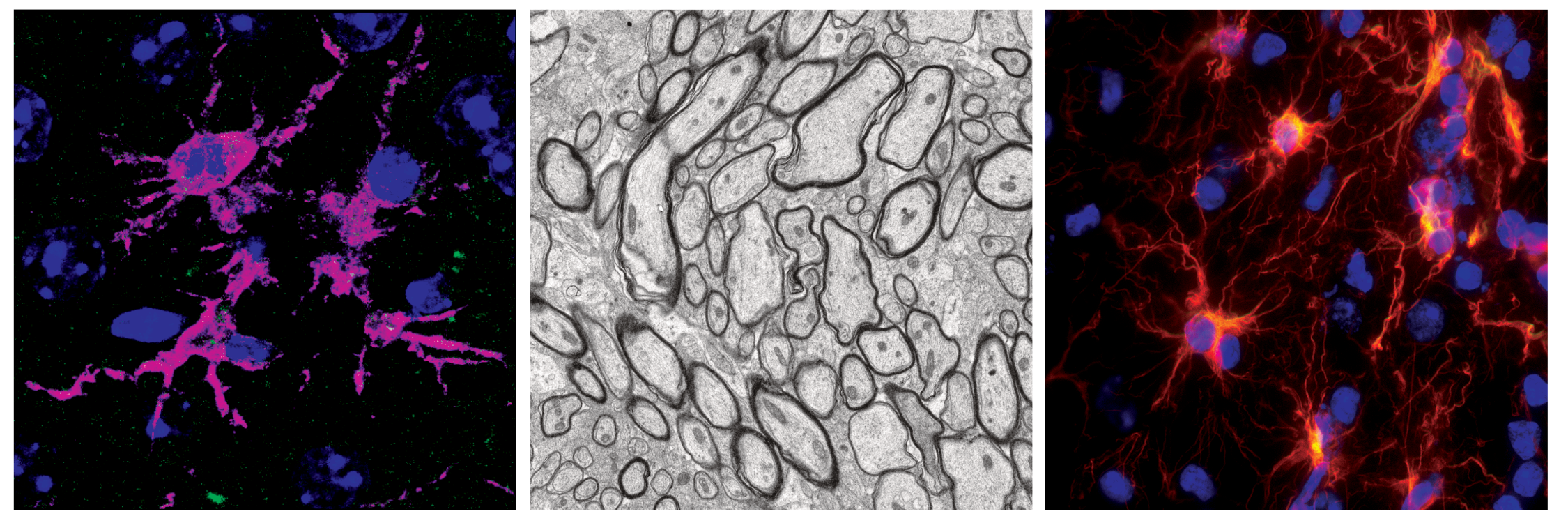 Representative images of microglia, myelin ultrastructure, and astrocytes in a wild-type mouse brain
